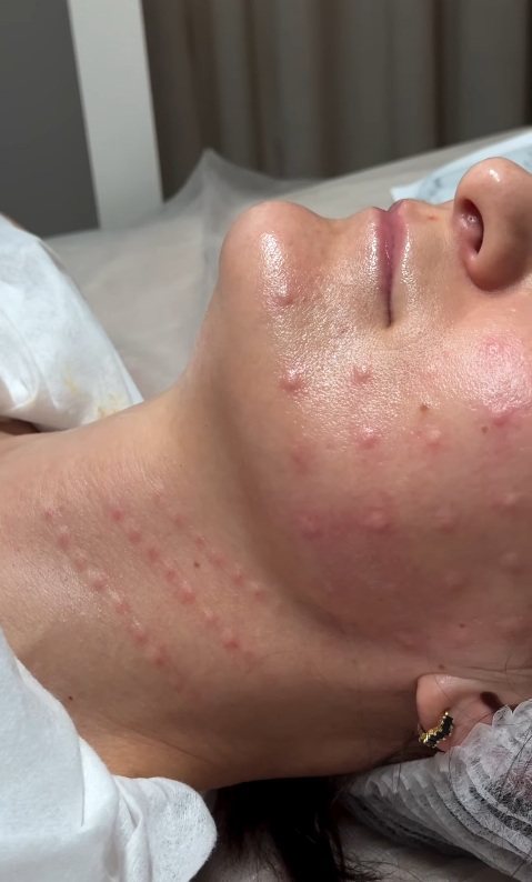 Terapia skóry w Skin Excellence Clinic